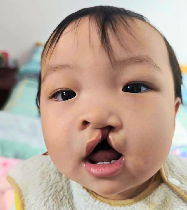 Close Up of Baby's Face