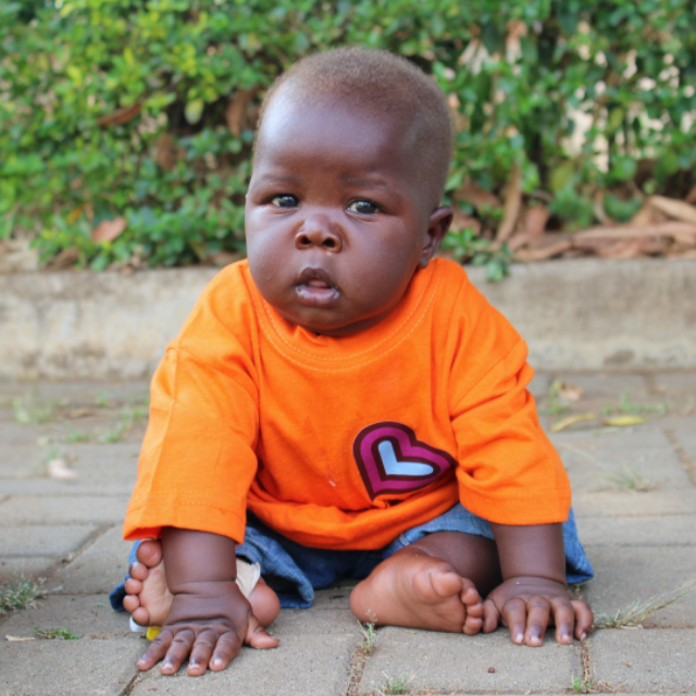 A toddler who received a hernia repair in one of LWB's hernia camps in Uganda
