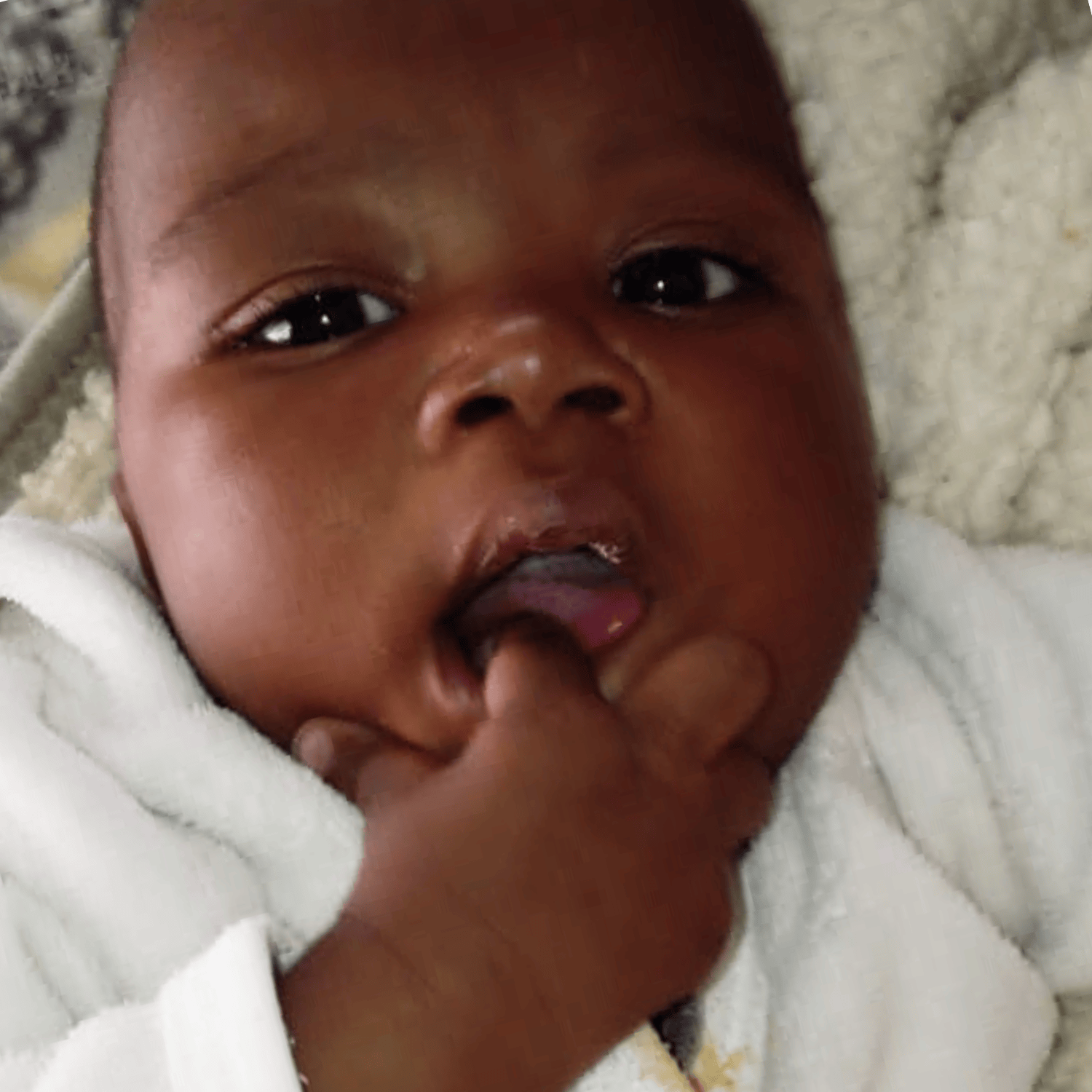 A baby boy from Zimbabwe who is receiving heart surgery through LWB's cardiac program. He looks at the camera with his finger in his mouth.